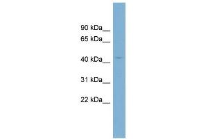 WB Suggested Anti-CRBN Antibody Titration: 0. (CRBN anticorps  (N-Term))