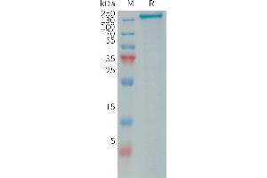 Human R1 Protein, His Tag on SDS-PAGE under reducing condition.