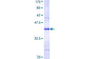 Image no. 1 for Carnitine O-Acetyltransferase (CRAT) (AA 445-544) protein (GST tag) (ABIN1350273)