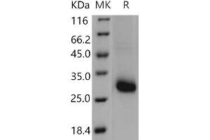 Western Blotting (WB) image for TIMP Metallopeptidase Inhibitor 1 (TIMP1) (Active) protein (ABIN7198251) (TIMP1 Protéine)