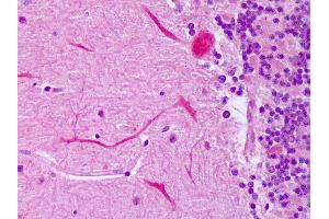 Anti-IGF2 antibody IHC of human brain, cerebellum, Purkinje. (IGF2 anticorps)