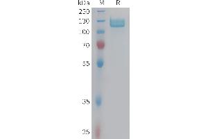 Human I Protein, hFc Tag on SDS-PAGE under reducing condition.