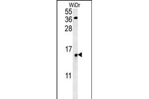C19orf50 Antibody (Center) (ABIN653085 and ABIN2842681) western blot analysis in WiDr cell line lysates (35 μg/lane). (C19orf50 anticorps  (AA 59-85))