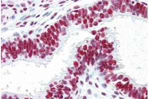 Human Uterus (Formalin-Fized, Paraffin-Embedded) stained with ACIN1 antibody ABIN461879 at 5 ug/ml followed by biotinylated goat anti-rabbit IgG secondary antibody ABIN481713, alkaline phosphatase-streptavidin and chromogen. (ACIN1 anticorps)