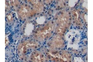 Detection of DUSP3 in Human Kidney Tissue using Polyclonal Antibody to Dual Specificity Phosphatase 3 (DUSP3)