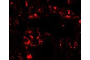 Immunofluorescence of FOXRED2 in human lung cells with FOXRED2 antibody at 20 ug/mL. (FOXRED2 anticorps  (N-Term))