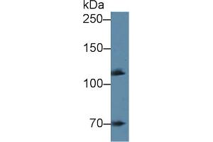 Detection of ADD1 in Mouse Cerebrum lysate using Polyclonal Antibody to Alpha Adducin (ADD1) (alpha Adducin anticorps  (AA 388-560))