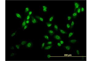 Immunofluorescence of monoclonal antibody to USF2 on HeLa cell. (USF2 anticorps  (AA 1-100))