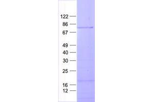Validation with Western Blot