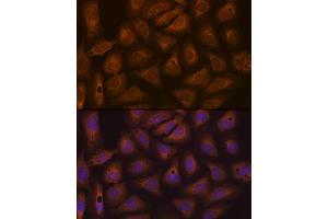 Immunofluorescence analysis of U-2 OS cells using CAD Rabbit mAb (ABIN7266064) at dilution of 1:100 (40x lens).