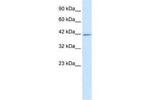 Western Blotting (WB) image for anti-IKAROS Family Zinc Finger 2 (IKZF2) antibody (ABIN2460270) (IKZF2 anticorps)