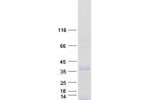 Validation with Western Blot