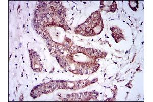 Immunohistochemistry (IHC) image for anti-Bone Morphogenetic Protein Receptor 1A (BMPR1A) (AA 179-378) antibody (ABIN1845272) (BMPR1A anticorps  (AA 179-378))