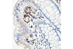 Immunohistochemistry of paraffin-embedded human colon using CD68 Rabbit pAb (ABIN6132070, ABIN6138218, ABIN6138221 and ABIN6217224) at dilution of 1:50 (40x lens). (CD68 anticorps  (AA 22-319))