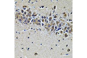 Immunohistochemistry of paraffin-embedded mouse brain using PLCG1 Antibody.