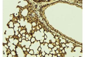 ABIN6269336 at 1/100 staining Mouse lung tissue by IHC-P.