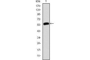 Western blot analysis using JUP mAb against human JUP (AA: 534-740) recombinant protein.