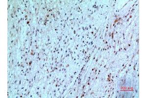 Immunohistochemistry (IHC) analysis of paraffin-embedded Human Brain, antibody was diluted at 1:100.
