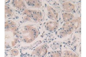 Detection of VEGFA in Human Stomach Tissue using Polyclonal Antibody to Vascular Endothelial Growth Factor A (VEGFA)