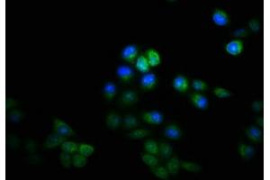 Immunofluorescence staining of Hela cells with ABIN7157464 at 1:133, counter-stained with DAPI.