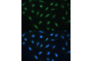Immunofluorescence analysis of U-2 OS cells using  antibody (ABIN6127378, ABIN6137233, ABIN6137235 and ABIN6217480) at dilution of 1:100.