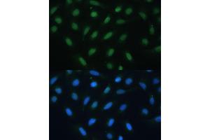 Immunofluorescence analysis of U-2 OS cells using  antibody (ABIN6127378, ABIN6137233, ABIN6137235 and ABIN6217480) at dilution of 1:100. (ATF3 anticorps  (AA 1-181))
