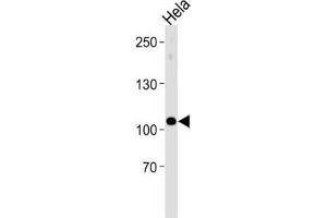 Western Blotting (WB) image for anti-Ubiquitin Protein Ligase E3C (UBE3C) antibody (ABIN3004610) (UBE3C anticorps)