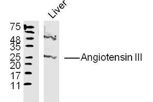 Liver lysates probed with Angiotensin III Polyclonal Antibody, Unconjugated  at 1:300 overnight at 4˚C.