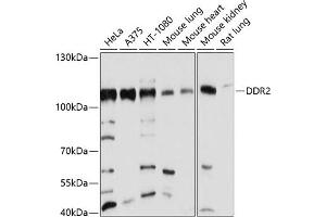 Western blot analysis of extracts of various cell lines, using DDR2 antibody (ABIN6130247, ABIN6139473, ABIN6139474 and ABIN6214178) at 1:1000 dilution. (DDR2 anticorps  (AA 290-400))