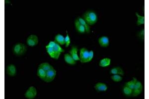 Immunofluorescence staining of MCF-7 cells with ABIN7148018 at 1:133, counter-stained with DAPI. (COPG2 anticorps  (AA 676-823))