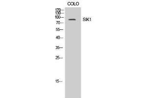 Western Blotting (WB) image for anti-Salt-Inducible Kinase 1 (SIK1) (Tyr86) antibody (ABIN3186959) (SIK1 anticorps  (Tyr86))