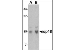 Western blot analysis of op18 in human brain tissue lysate with this product at (A) 0. (Stathmin 1 anticorps  (N-Term))