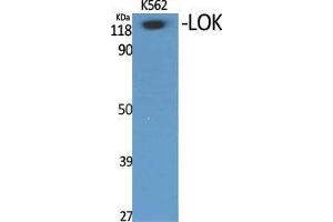 Western Blot (WB) analysis of specific cells using LOK Polyclonal Antibody. (STK10-A anticorps  (Internal Region))