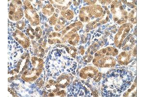 Enolase 3 antibody was used for immunohistochemistry at a concentration of 4-8 ug/ml. (ENO3 anticorps)