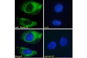 ABIN185358 Immunofluorescence analysis of paraformaldehyde fixed HeLa cells, permeabilized with 0. (PLXND1 anticorps  (Internal Region))