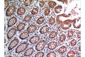Immunohistochemistry (IHC) analysis of paraffin-embedded Human Colon, antibody was diluted at 1:100. (TNF alpha anticorps  (Internal Region))
