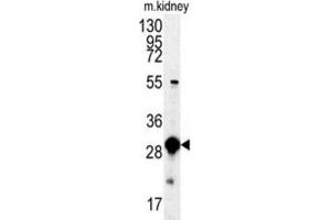 Western Blotting (WB) image for anti-Mercaptopyruvate Sulfurtransferase (MPST) antibody (ABIN3003390) (MPST anticorps)