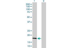Western Blot analysis of AHNAK expression in transfected 293T cell line by AHNAK MaxPab polyclonal antibody. (AHNAK anticorps  (AA 1-149))