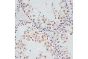 Immunohistochemistry of paraffin-embedded rat testis using Phospho-RPS6K-S376 antibody (ABIN7270039) at dilution of 1:100 (40x lens).