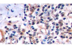 anti-TNF Receptor Superfamily, Member 6 (FAS) (AA 22-172) antibody