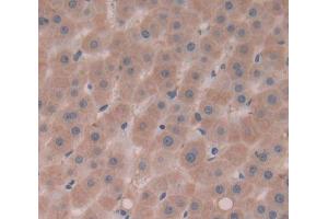 IHC-P analysis of Kidney tissue, with DAB staining. (Complement Factor I anticorps  (AA 28-243))