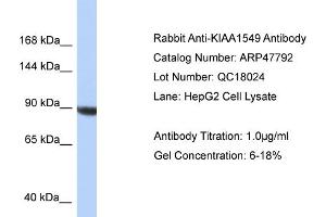WB Suggested Anti-KIAA1549 Antibody   Titration: 1. (KIAA1549 anticorps  (C-Term))