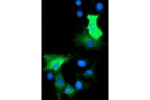 Immunofluorescence (IF) image for anti-Histone Deacetylase 6 (HDAC6) antibody (ABIN1498618)