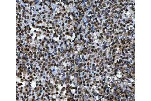 IHC analysis of TIP49A/RUVBL1 using anti-TIP49A/RUVBL1 antibody (ABIN7599928). (RUVBL1 anticorps  (AA 13-23))