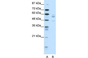 WB Suggested Anti-PAX6 Antibody Titration:  0. (PAX6 anticorps  (N-Term))