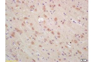 Formalin-fixed and paraffin embedded rat brain labeled with Rabbit Anti ARP3 Polyclonal Antibody, Unconjugated (ABIN1387419) at 1:200 followed by conjugation to the secondary antibody and DAB staining (ANGPTL6 anticorps  (AA 301-400))