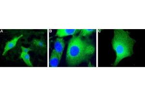 Expression of Mitochondrial uncoupling protein 2 (UCP2) in mouse C2C12 cells. (UCP2 anticorps  (Intracellular))