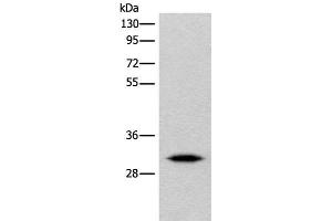 Western blot analysis of Human cerebrum tissue lysate using IMPA1 Polyclonal Antibody at dilution of 1:360 (IMPA1 anticorps)