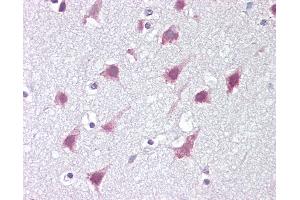 Anti-ZMYM3 antibody IHC of human brain, cortex. (ZMYM3 anticorps  (C-Term))
