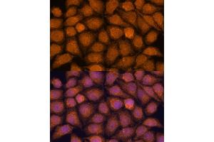 Immunofluorescence analysis of HeLa cells using TNFL2 antibody (ABIN6133093, ABIN6149298, ABIN6149299 and ABIN6217788) at dilution of 1:100. (TNFAIP8L2 anticorps  (AA 1-184))